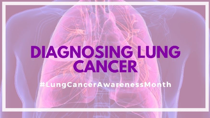 DIAGNOSING LUNG CANCER